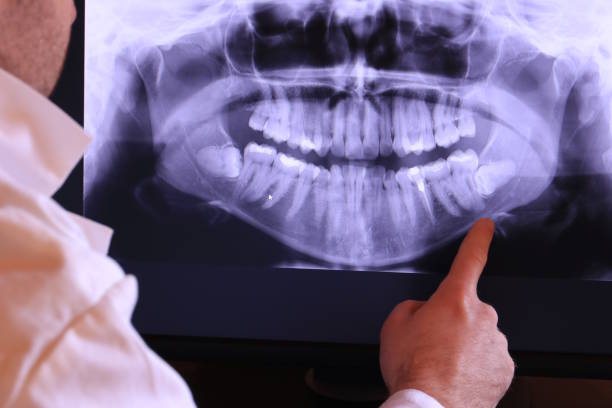 Best Emergency Dental Care for Broken or Chipped Teeth in Garden Grove, FL