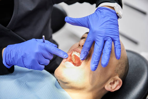 Best Emergency Treatment for Dental Infections or Abscesses in Garden Grove, FL
